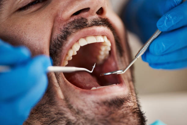 Best Emergency Cosmetic Dentistry (e.g., broken veneers) in Boonville, CA