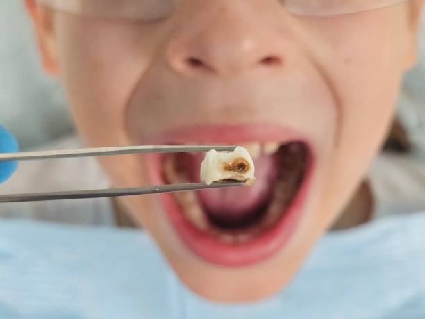Best Emergency Denture Repair in Boonville, CA